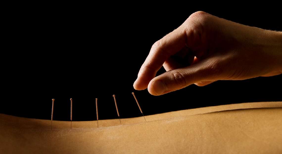 Akupunktūra – gydymo būdas, kuris veiksmingas tūkstantmečius